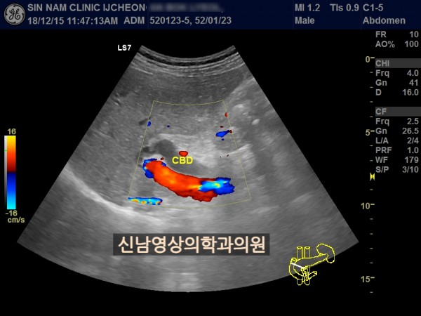 a91aa93529db81accb78722c2d5bfa6b_1757902