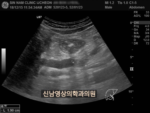 a91aa93529db81accb78722c2d5bfa6b_1757902